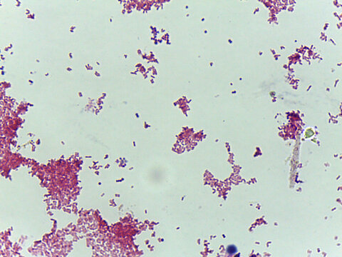 Microscopic Field of Red/Pink Bacteria Clustered in Colonies, Suggesting a Gram-Negative Stains
