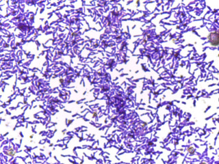 Microscopic Section of Lymphoid Tissue Showing Contrasting Follicle Zone