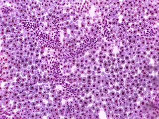 Microscopic Cross-Section of Arum Maculatum Anther Showing Pollen Sac