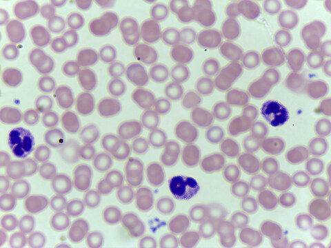 Microscopic View of a Peripheral Blood Smear Showing Red Blood Cells and White blood cell
