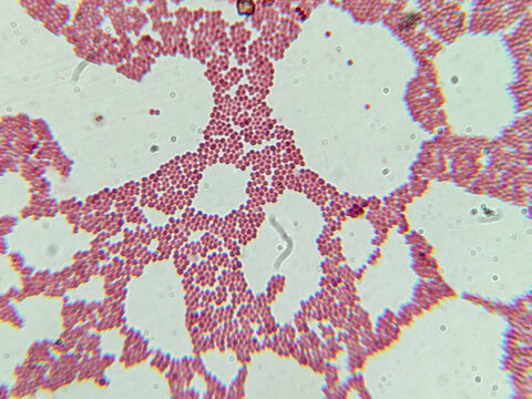 Microscopic View of Purple Cocci Bacteria Clustered in Grapelike Formation
