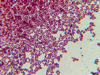 Fototapeta premium Microscopic View of Purple Cocci Bacteria Clustered in Grapelike Formation