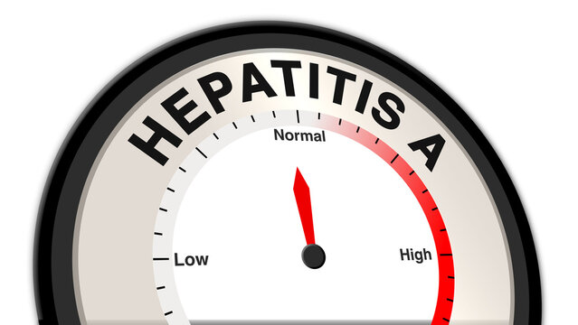 Hepatitis A at moderate severity displayed on a barometer or tachometer, indicating manageable symptoms with ongoing monitoring, treatment, and preventive care to support recovery
