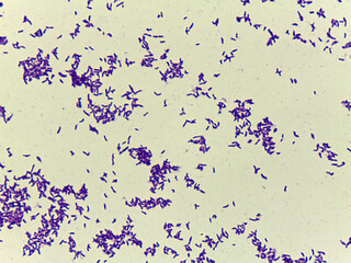 Microscopic Field of Dense, Clumped Bacilli (Rod-Shaped Bacteria) After Gram Stainin
