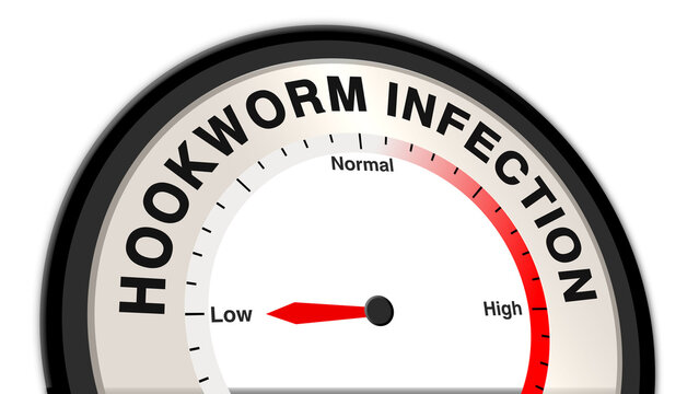 Hookworm infection at early stage shown on a barometer or tachometer, reflecting mild symptoms and emphasizing the importance of early diagnosis, anthelmintic treatment, and prevention