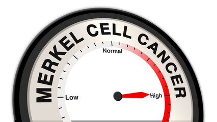 Merkel cell cancer at high severity displayed on a barometer or tachometer, reflecting aggressive growth, advanced stages, and urgent treatment needs, requiring immediate medical intervention