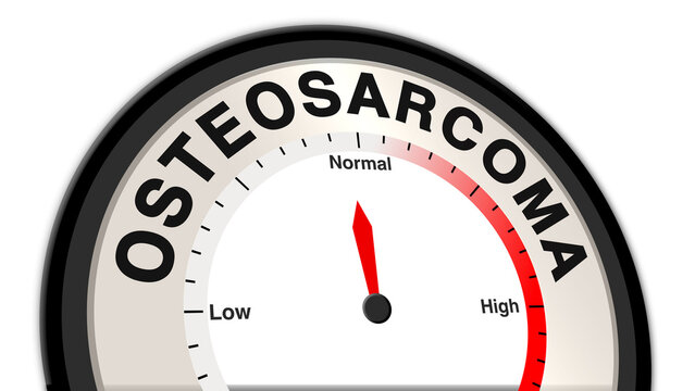 Osteosarcoma at normal severity displayed on a barometer or tachometer, indicating controlled symptoms with manageable bone cancer progression, requiring ongoing monitoring and treatment