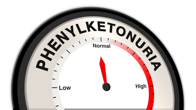 Phenylketonuria at normal severity displayed on a barometer or tachometer, indicating manageable metabolic dysfunction, controlled symptoms, and the need for routine monitoring and dietary care