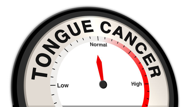 Tongue cancer at a moderate stage displayed on a barometer or tachometer, symbolizing symptoms like a visible lump or pain, requiring ongoing monitoring and treatment to manage growth
