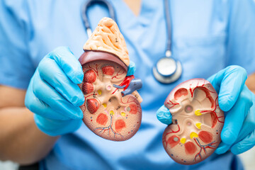 Chronic kidney disease, doctor with model for treatment urinary system, urology, Estimated glomerular filtration rate eGFR.