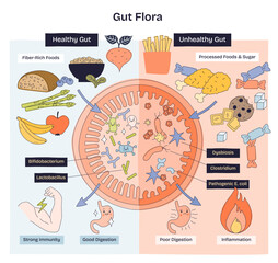 Gut flora doodle diagram contrasts healthy vs unhealthy microbiome, linking fiber foods to good digestion and sugar to dysbiosis, key objects, intestine, bacteria, foods. Doodle style diagram