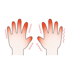 主線ありの寒さで赤くなった霜焼けの手のベクターイラスト