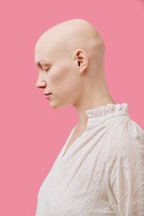 Caucasian young adult woman with alopecia standing in profile with eyes closed against pink background, showing smooth bald scalp and delicate facial features