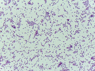 Obraz premium Microscopic Field of Purple Rod-Shaped Bacteria (Bacilli) in Dense, Clustered Colonie