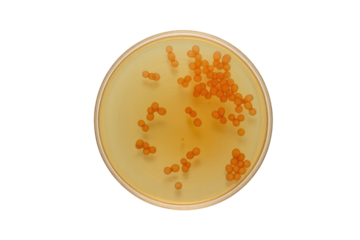 Vibrant orange microbial colonies cultivated on agar in a petri dish, showcasing bacterial growth for scientific study or lab contamination. background removed