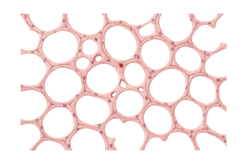 Histological slide of alveoli showing alveolar pores and type I cells.