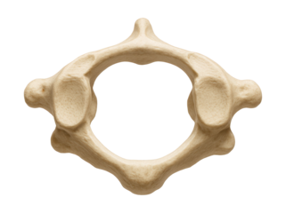 Atlas vertebra featuring a ring-like structure with front and back arches.