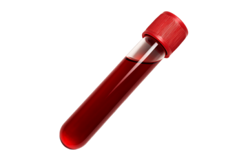 A clinical image of a biological sample in a test tube, representing modern medicine, disease detection, and DNA analysis