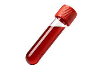 Medical Test Tube with Blood Sample for Laboratory Analysis and Diagnosis Isolated on white