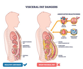 Visceral fat dangers compare healthy vs high-fat abdomens, showing organs, visceral fat around the belly, and risk icons for heart and brain. Outline diagram