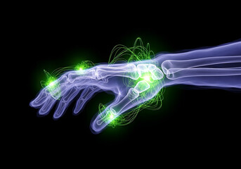 Fototapeta premium X-ray image of a hand and wrist with green glowing points highlighting joints, possibly indicating pain or inflammation.