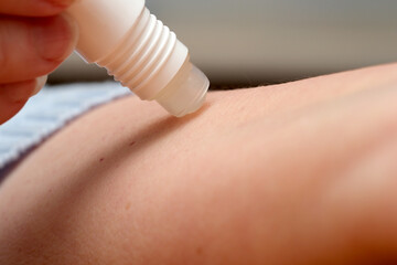 Applying soothing gel to relieve skin irritation in a cozy setting