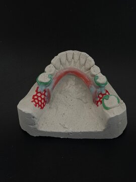 Wax prototype of a metal b&uuml;gel with a refractory model