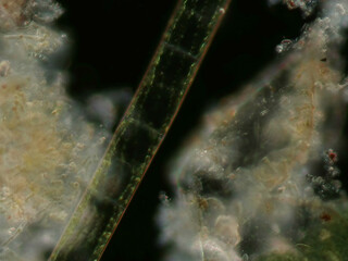 Spirogyra sp. green algae under darkfield microscope at 20x0.50 NA magnification