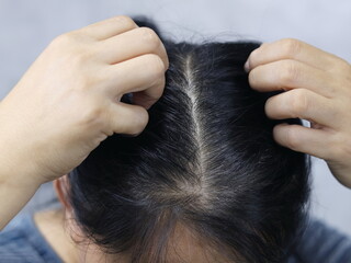 Obraz premium The image shows a person scratching their head.