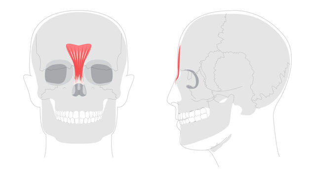 Procerus - Nasal muscle shown in anatomy diagram, responsible for drawing the skin between the eyebrows downward, expressing frowning medical reference and educational illustration.