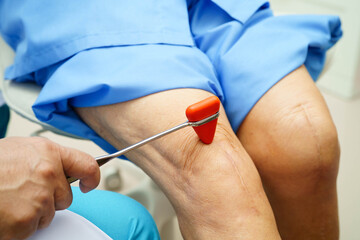 Asian doctor knock on knee reflex nerve for check and treatment senior patient in hospital.
