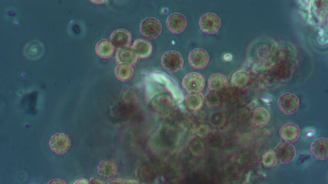Round spores of the gib fungus when magnified under a dark-field microscope. The spores move in an aqueous solution and can cause allergies in humans.