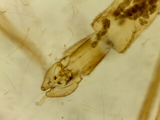 Microscopic Morphology of Culex pipiens Mosquito Larval or Pupal Head Capsule and Appendage