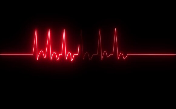 Red ekg line with peaks and flatline on a black background showing heart activity and failure