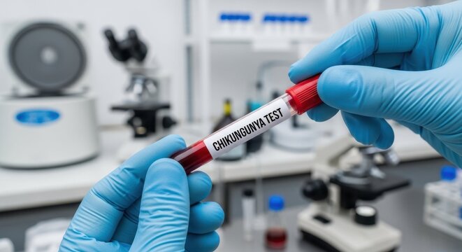 Blood sample test for mosquito-borne viral diseases such as Chikungunya, Dengue, Zika and West Nile virus in modern medical laboratory, healthcare research and diagnosis concept
