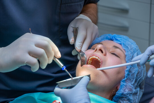 Dental professional works on patient mouth during application of bone graft material. Assistant helps maintain access while woman lying on chair