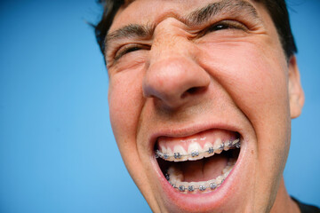 Young person smiling with braces against blue background