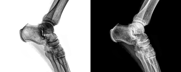 Radiology Image of Ankle Joint in Lateral View X-Ray Used for Fracture Detection and Bone Evaluation Isolated on Transparent or White Background for Orthopedic Study