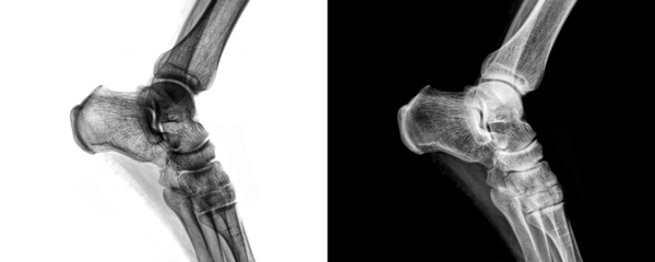 Radiology Image of Ankle Joint in Lateral View X-Ray Used for Fracture Detection and Bone Evaluation Isolated on Transparent or White Background for Orthopedic Study