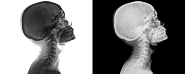 Lateral View Neck X-Ray of Soft Tissues and Cervical Spine Structures for Diagnostic Evaluation Isolated on a Transparent or White Background