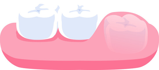 Wisdom tooth inside gum illustration transparent design. Dental care concept.