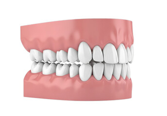 Realistic dental model showing upper and lower jaw teeth alignment and occlusion details