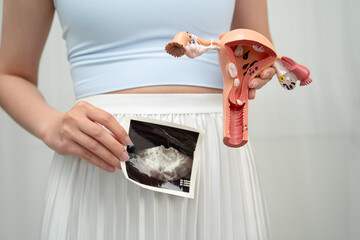 Uterus ultrasound, Asian woman holding human anatomy model.