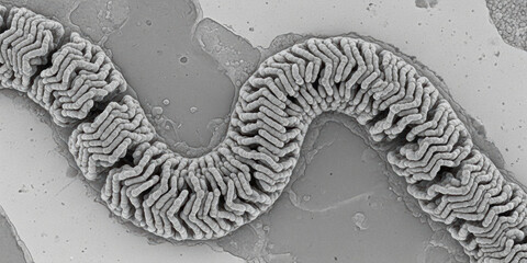 Measles Nucleocapsid Protein Assembly Showcase of Helical Ribonucleoprotein Complex