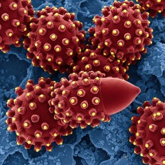 High Resolution CryoSEM of Rabies Virus Virion Structure Essential for Neurological Infection