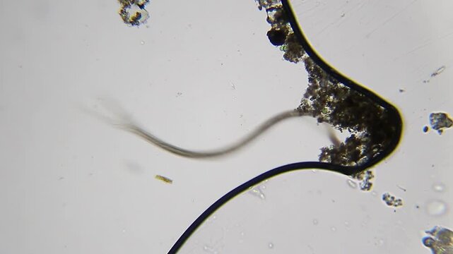 Fast moving nematode under bright field microscope at 100x magnification