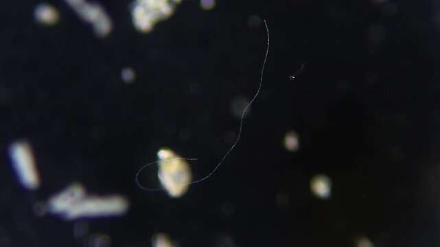 Cyanobacteria moving with protozoan passing by under dark field microscope at 100x magnification