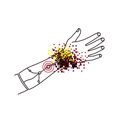 An abstract illustration depicting pain, inflammation, or a medical condition on a human wrist, showing nerve pathways and a burst of colored particles.