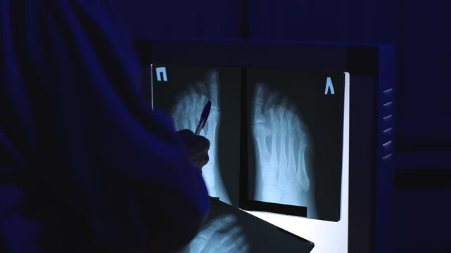 Foot X-ray. X-ray viewing lamp. Slow motion. High quality 4k footage