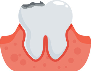 Cartoon illustration of a damaged tooth with gingivitis, emphasizing the importance of dental hygiene and treatment